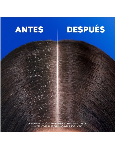 HS CHAMPU 90ML VIAJE CLASICO