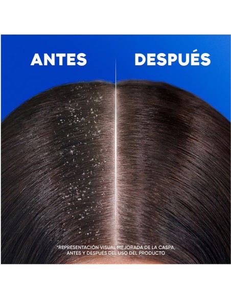 HS CHAMPU 90ML VIAJE CLASICO