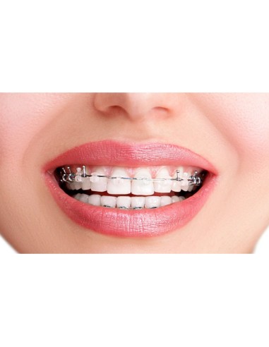 DENTINET CEPILLO DENTAL BRACKETS DUREZA MEDIA