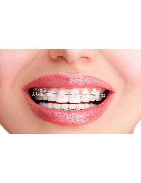 DENTINET CEPILLO DENTAL BRACKETS DUREZA MEDIA