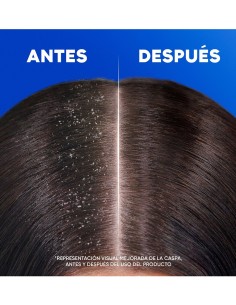 H&S Champú Mentol 230 ml, limpieza profunda con frescor intenso 2