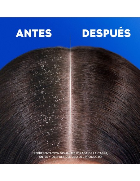 Champú anticaspa H&S Mentol, cuero cabelludo limpio y revitalizado