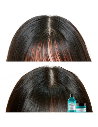L'Oréal Scalp Advanced Champú Purificante Anti-Grasa 300 ml