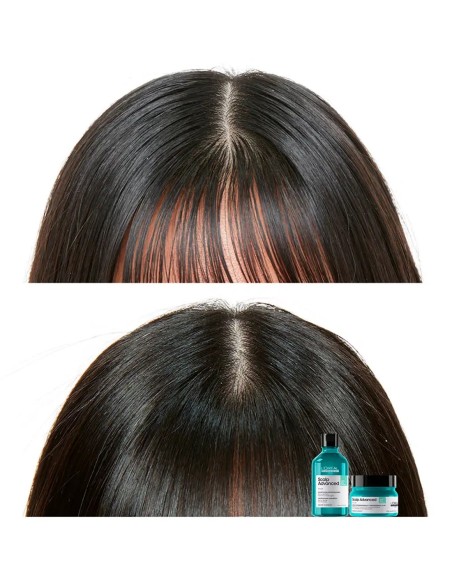 L'Oréal Scalp Advanced Champú Purificante Anti-Grasa 300 ml