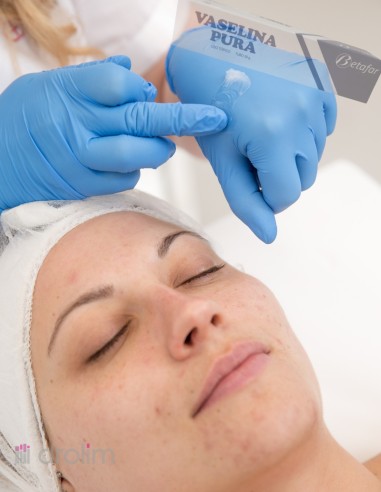 Vaselina Betafar: protector cutáneo de 60g.