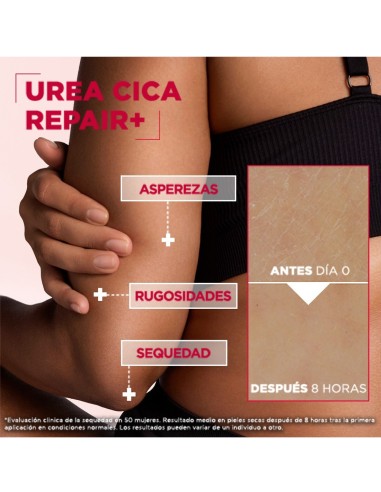 Bálsamo Mixa con urea para piel áspera 400ml.