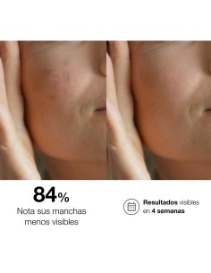 Bella Aurora Bio10 Forte Noche sérum despigmentante intensivo 2