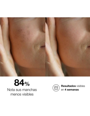 Sérum Noche Bella Aurora bio10 forte Despigmentante 30ml