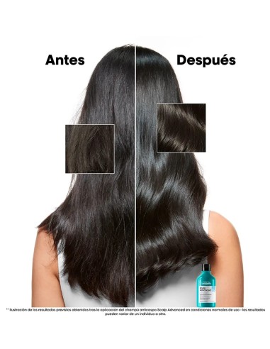 Champú L'Oréal Scalp Advanced con Piroctone Olamine