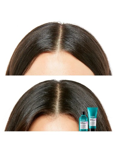 Champú Profesional L'Oréal Scalp Advanced efecto calmante
