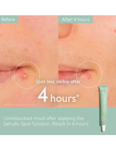 Caudalie Vinopure Stop Granos efecto rápido