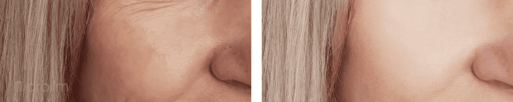 Cremas y Tratamientos Faciales Anti-Manchas y Rojeces - Cuidado y Protección para tu Piel